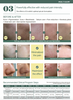 Peel N Glow Treatment (One application)